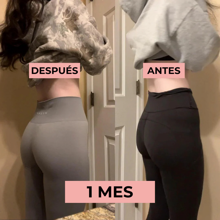 Antes y después 1 mes EMS Body Sculpt